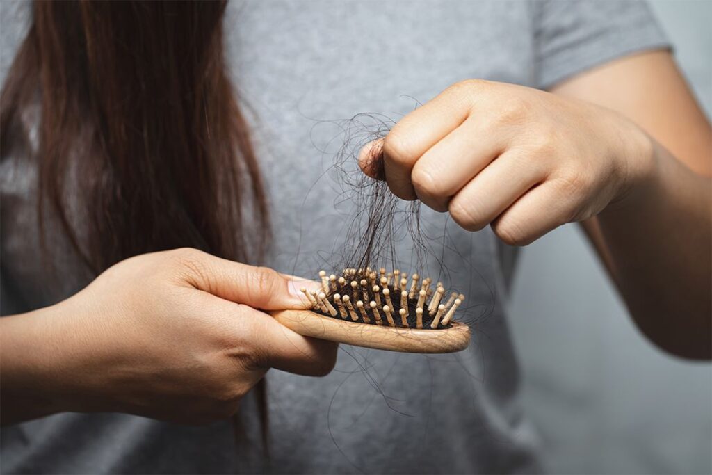 Por qué se cae el pelo en el posparto